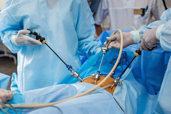Top Laparoscopic Surgeon in Dwarka, Delhi: Expert Care with Advanced Minimally Invasive Techniques