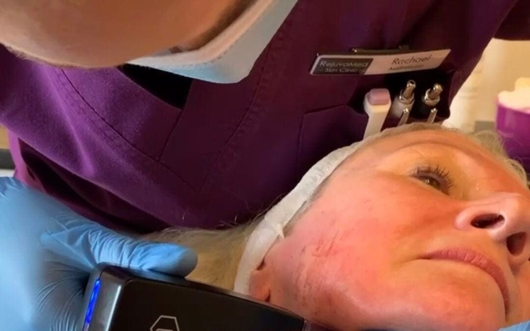 What Is Morpheus8 Treatment? The UK’s New Favourite in Non-Surgical Skin Rejuvenation | by Rejuvamed Skin Clinic | May, 2025 | Medium