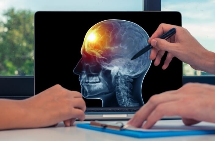 Personalized Brain Tumour Treatment for Long Term Care