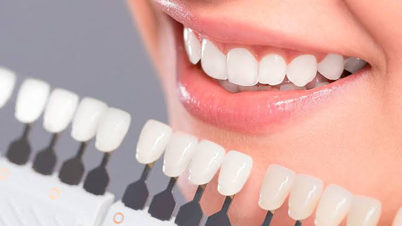 Experience better transformation in smile with porcelain dental veneers – Hawthorn East Dental