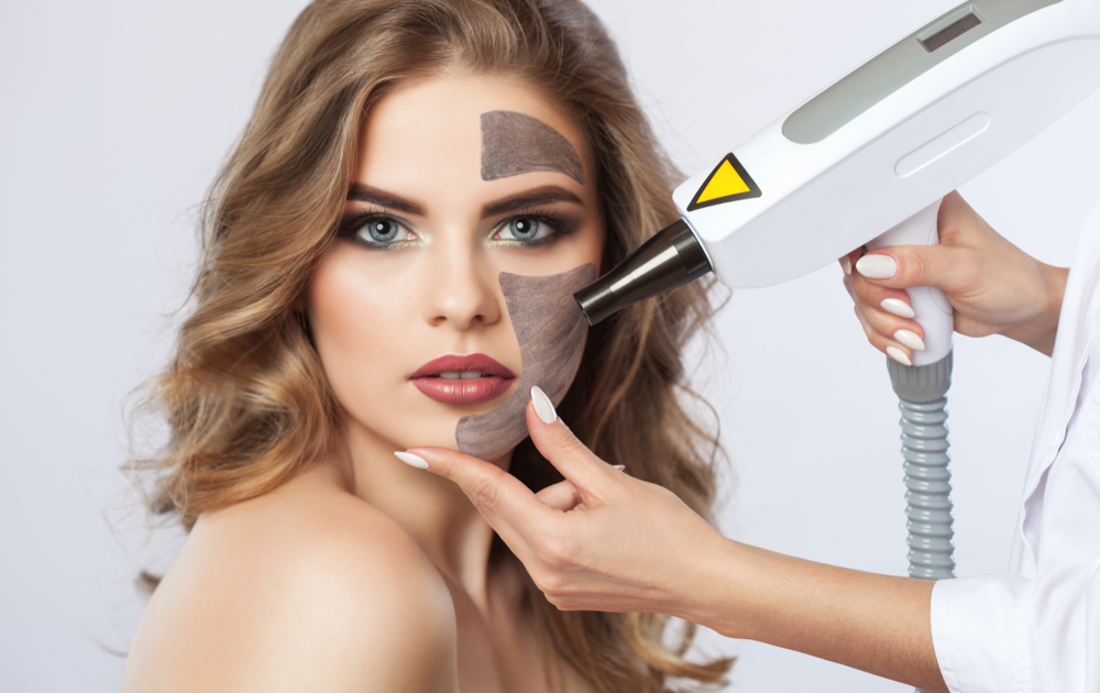 Feel Fresh and Glow Naturally with a Carbon Facial Treatment | by Aesthetics Redefined | Jun, 2025 | Medium
