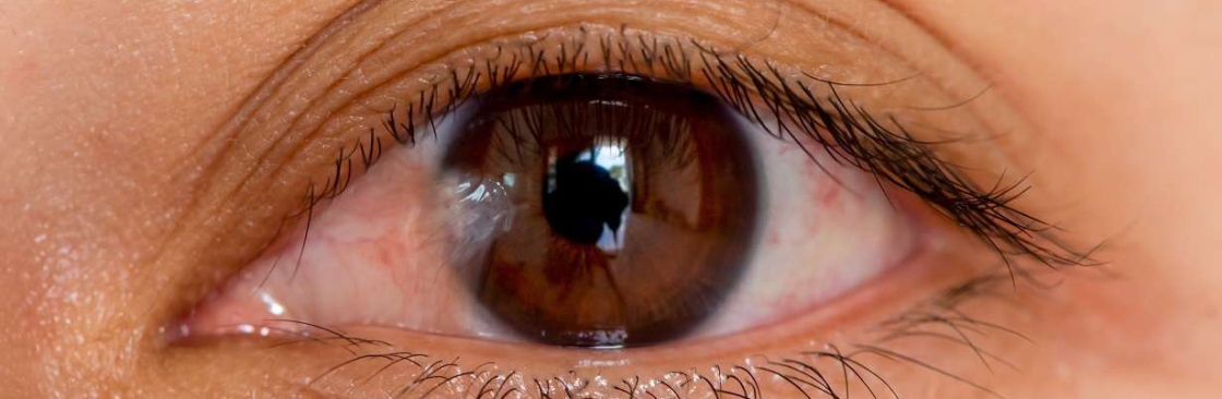 Houston Lasik and Eye Cover Image