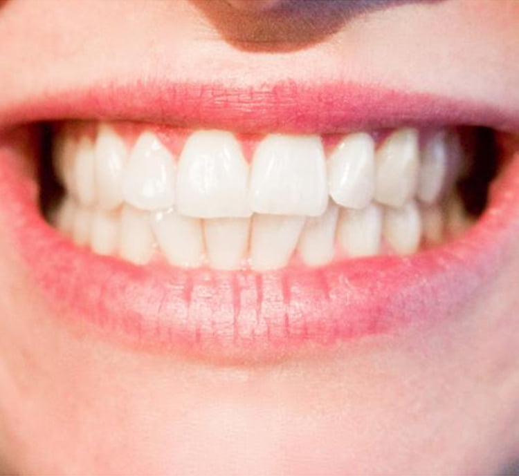 Teeth Whitening Dentist Melbourne | Holistic Dental Donvale