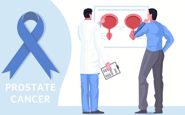 How Age Affects the Risk of Prostate Cancer