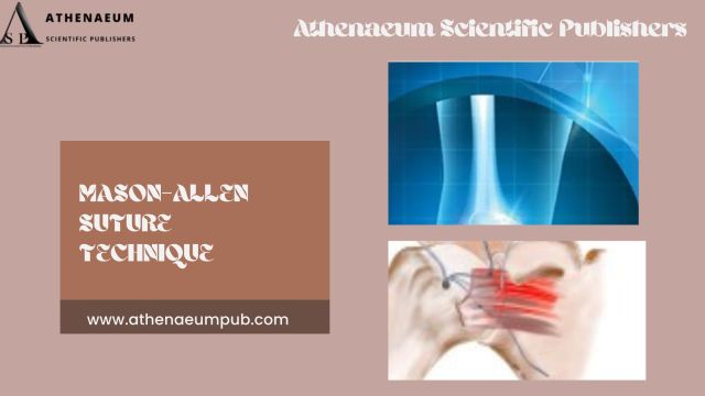 Mastering the Mason-Allen Suture Technique: Insights from Athenaeum Scientific Publishers – @athenaeumscientificpublishers on Tumblr