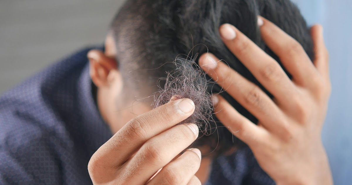 Hair Medicine vs. Natural Remedies: Which Is Better for Men?