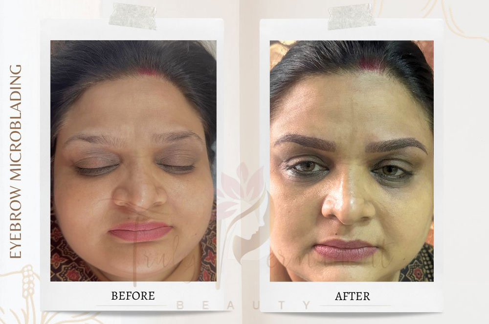 Eyebrow Microblading in Kolkata - Permanent Eyebrow | Truly Permanent Beauty