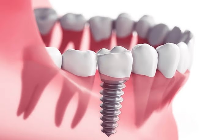 Orthodontist Doctor in RR Nagar