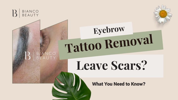 PPT - Eyebrow Tattoo Removal Leave Scars? What You Need to Know PowerPoint Presentation - ID:14442109
