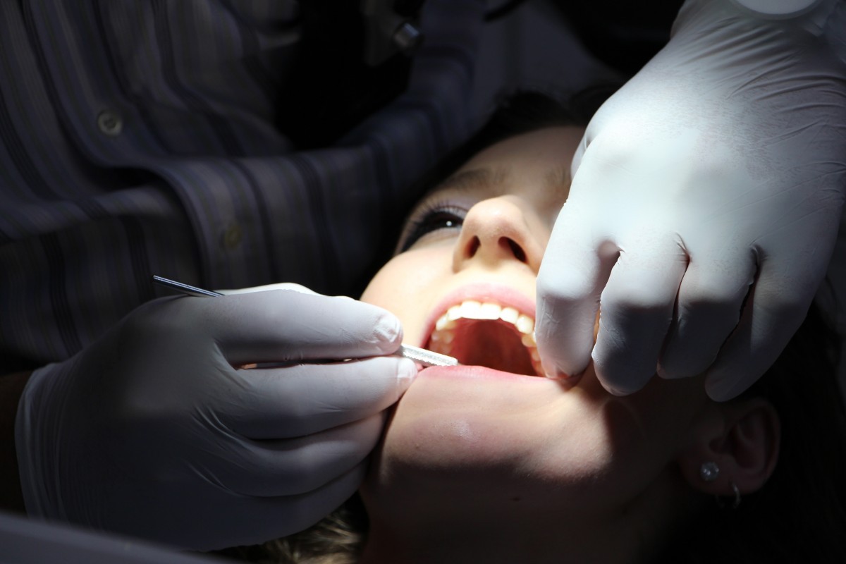 Preparation Tips for Wisdom Teeth Removal: What You Need to Know – @hawthorneastdentalme on Tumblr