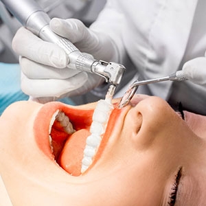 Teeth Whitening in Baldivis, Teeth Whitening Services | QVC Dental