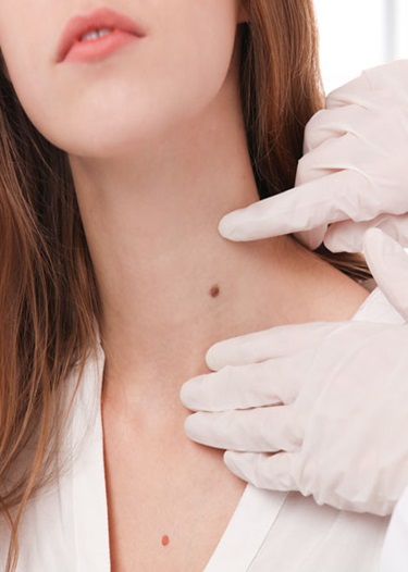 Minor Skin Procedure Dandenong, Dandenong South
