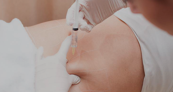 Fat Melting Injections — Sculpt Your Body Without Surgery | by Slim Spa | Oct, 2025 | Medium