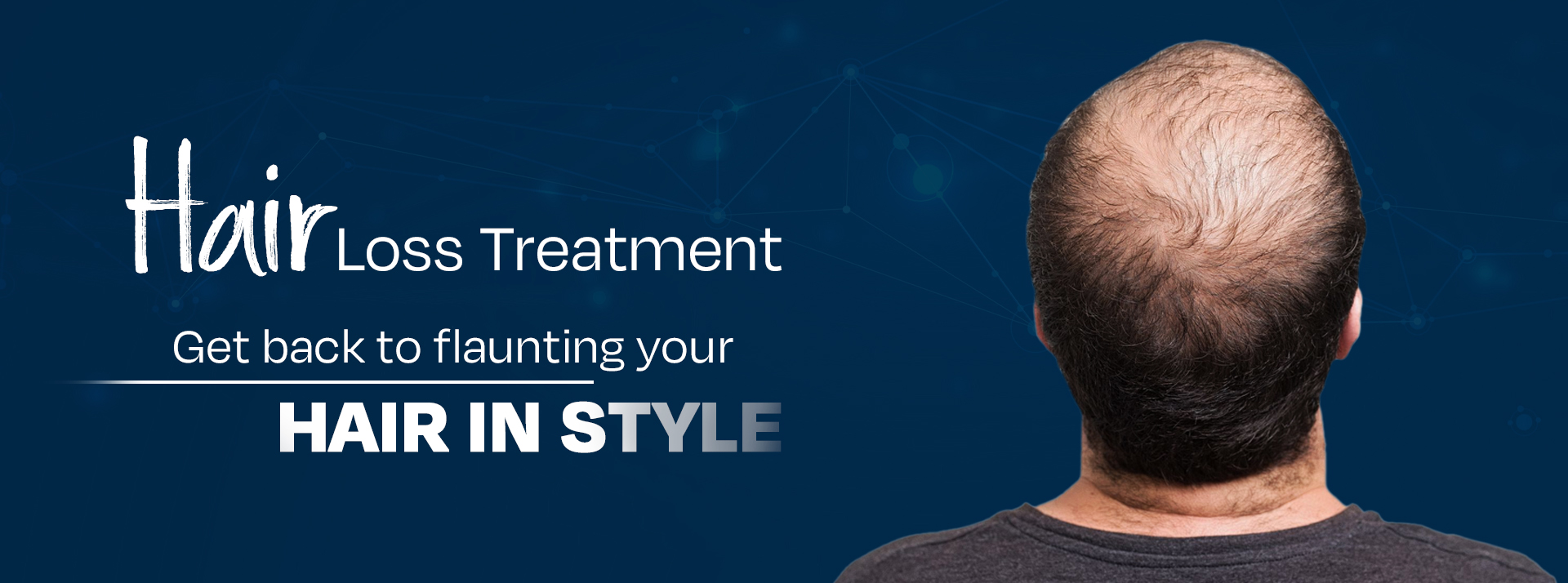 Best Hair Loss Treatment in Noida | Apolo Hair Clinic