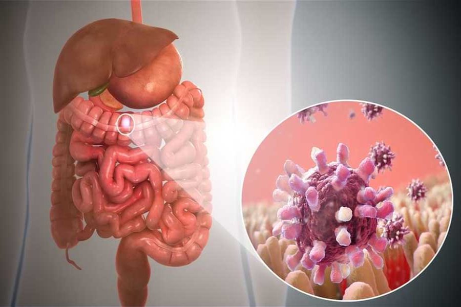 GI Cancer Surgeon in Hyderabad | Best Stomach Cancer Surgeon Secunderabad