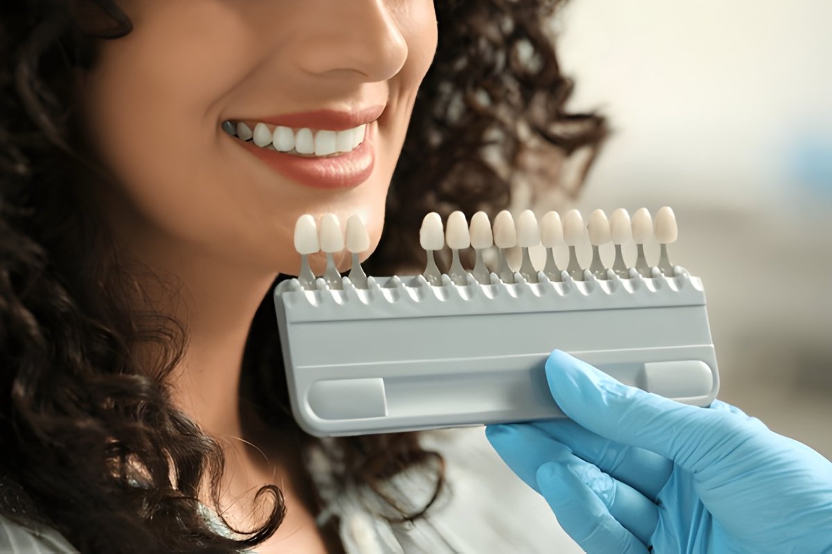 How Cosmetic Dentistry Can Change Your Life: Real Benefits You Never Expected – Carlisle Dental Care