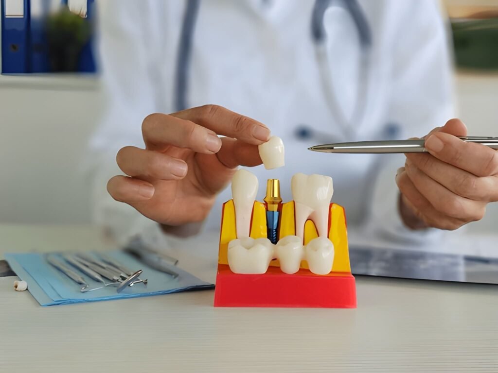 Dental Implant Myths Busted: What Actually Happens During Treatment