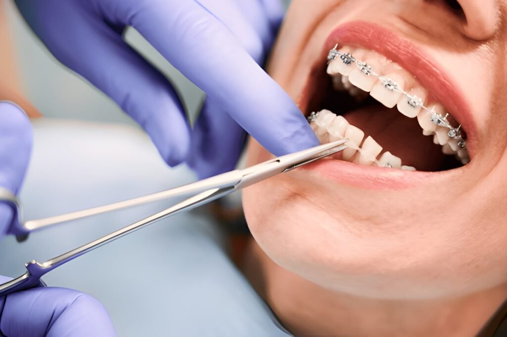 Why Visiting an Orthodontist Could Be the Best Decision for Your Smile - Carlisle Dental Care