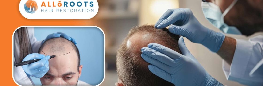 Allo Roots Cover Image