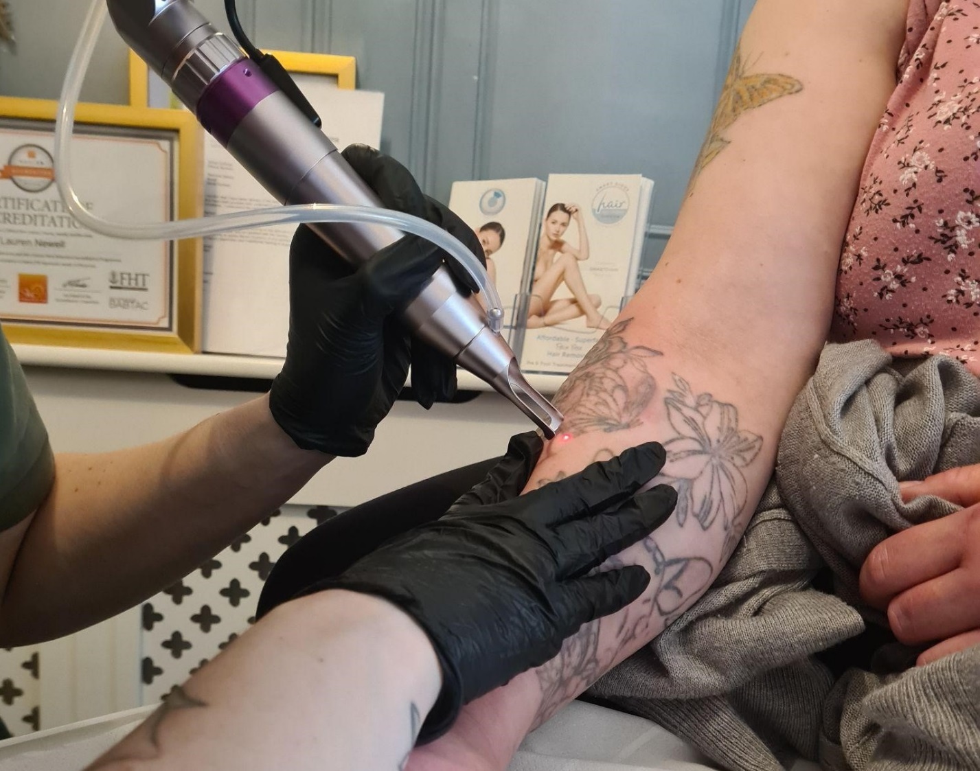 UK Laser Tattoo Removal Qualification Levels Explained