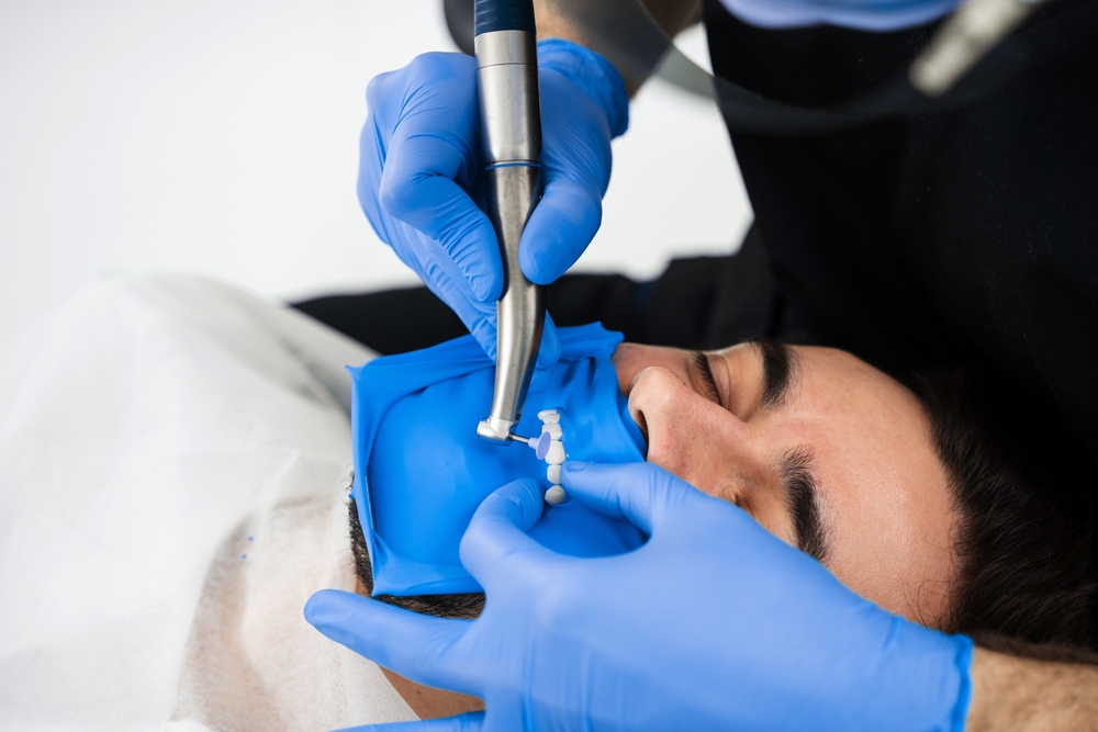 Dental Implants in Oakville, ON – The Gold Standard Solution