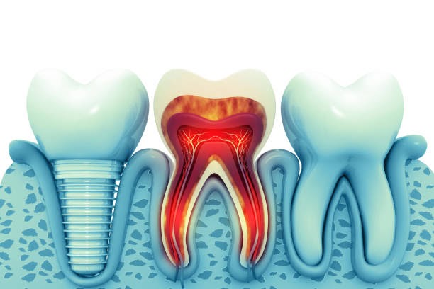 Bright Smiles, Healthy Lives: Discover Expert Dental Care in Astoria