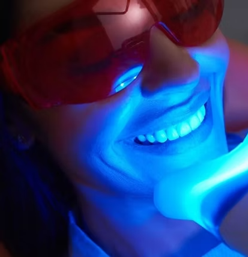 Teeth Whitening Secrets for a Brighter, Confident Smile