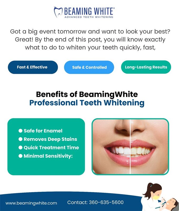 Beaming White Professional Teeth Whitening - Gifyu