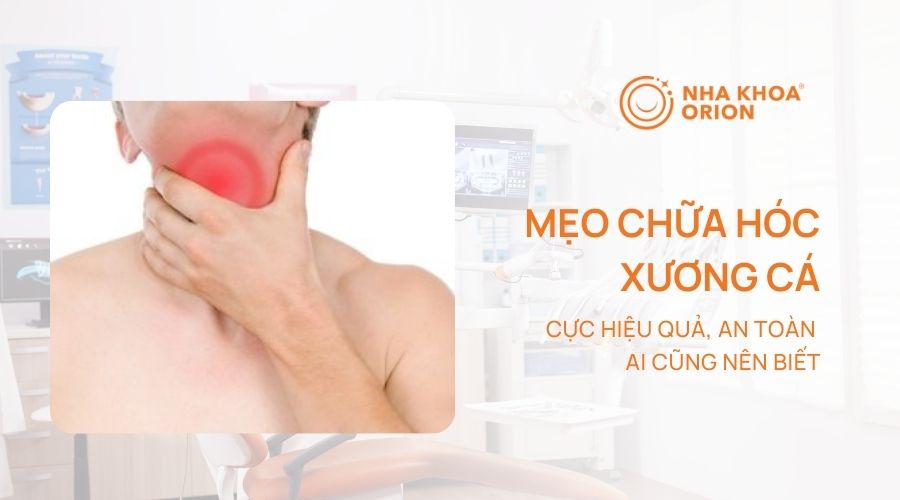 10 Mẹo chữa hóc xương cá tại nhà hiệu quả, an toàn ai cũng nên biết