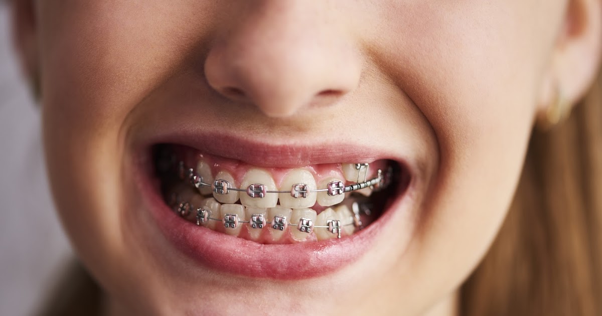 What Is Periodontal Disease and How Is It Treated?