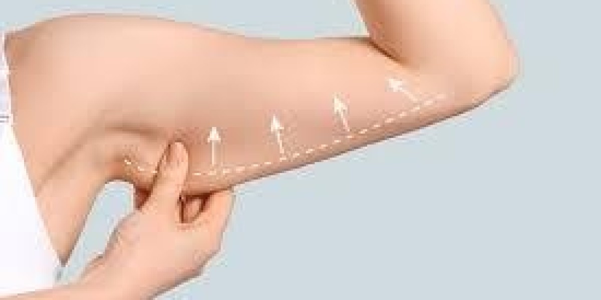Can Arm Lift Surgery Remove Excess Skin Permanently?