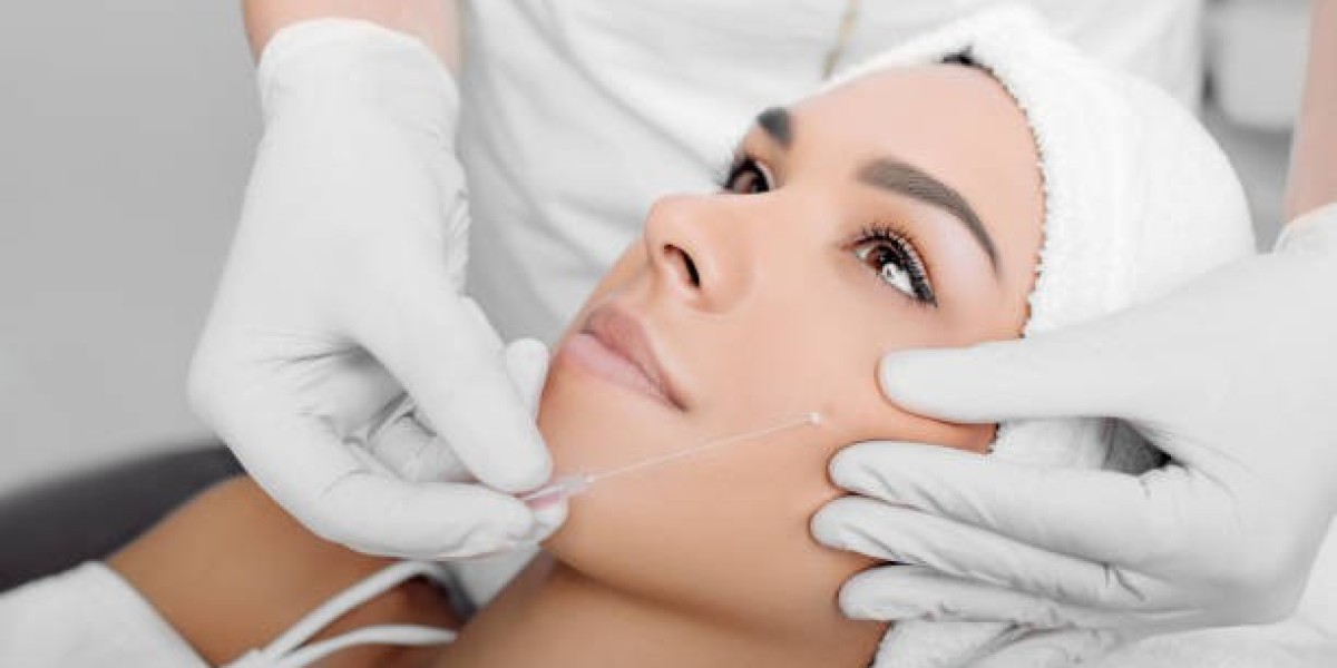Why Thread Lift in Islamabad Is Becoming the Top Choice for Facial Rejuvenation