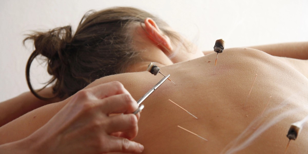 Acupuncture for Weight Control and Healthy Living