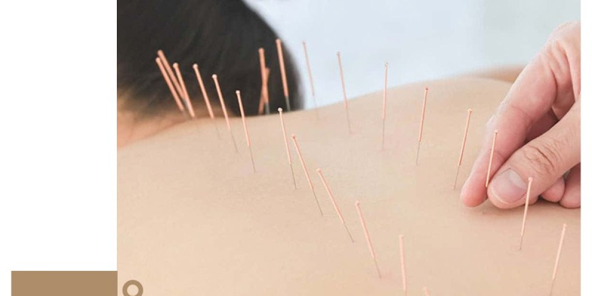 What Is Somatic Experiencing and How Can It Help with Stress?