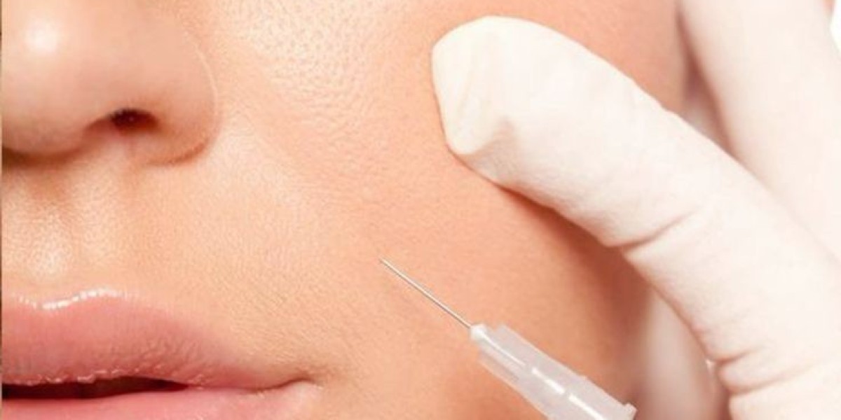 Belotero Fillers in Dubai for Subtle Anti-Aging Success