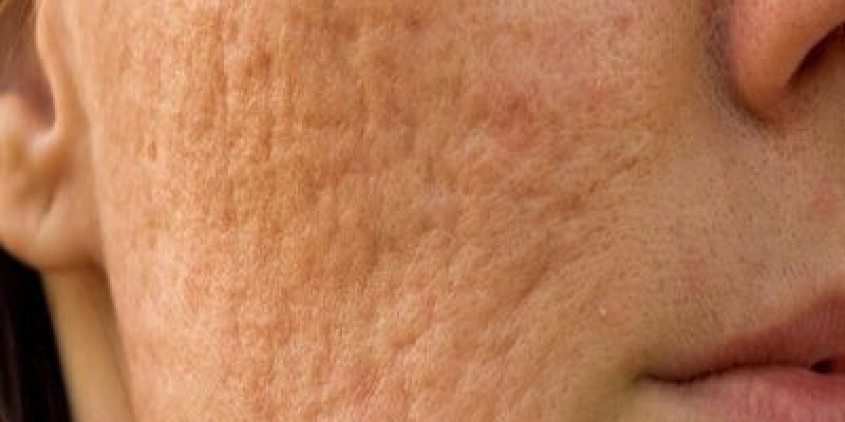 Best Techniques for Scar Removal in Dubai for All Skin Types