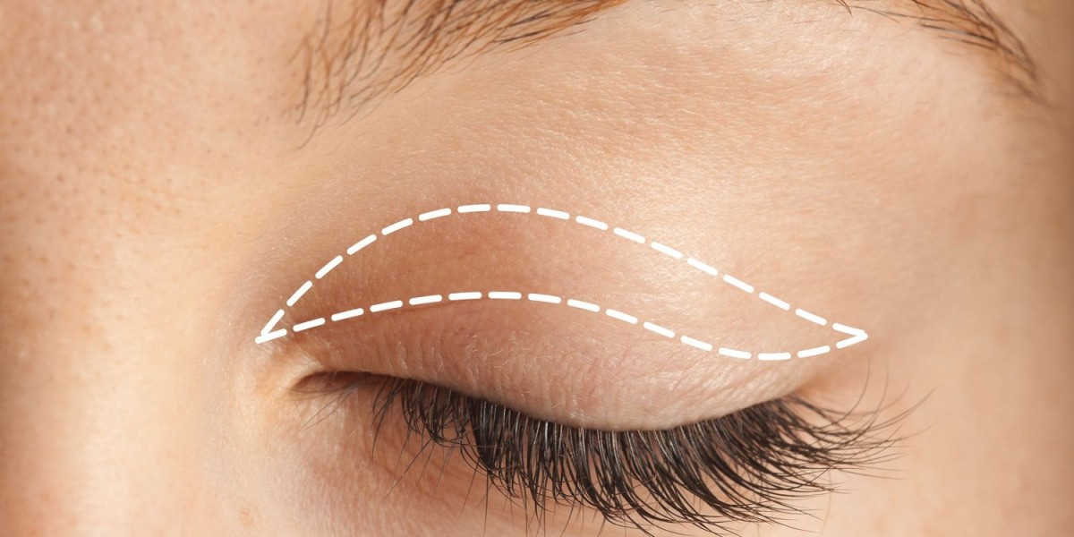 The Growing Popularity of Blepharoplasty in Islamabad