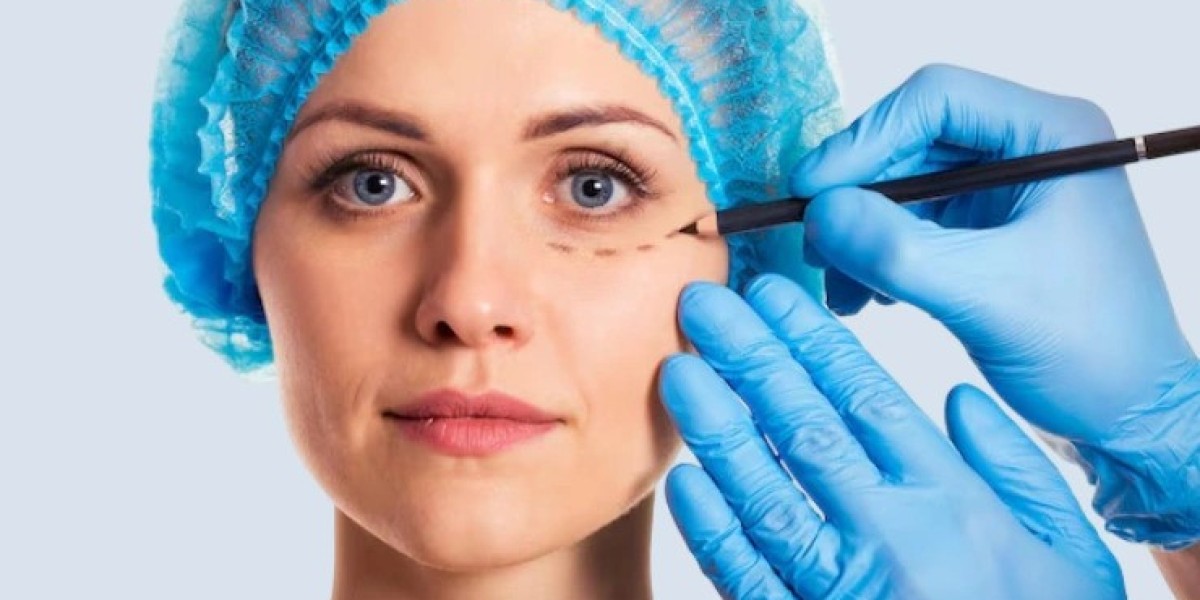 What Factors Influence Blepharoplasty Results?