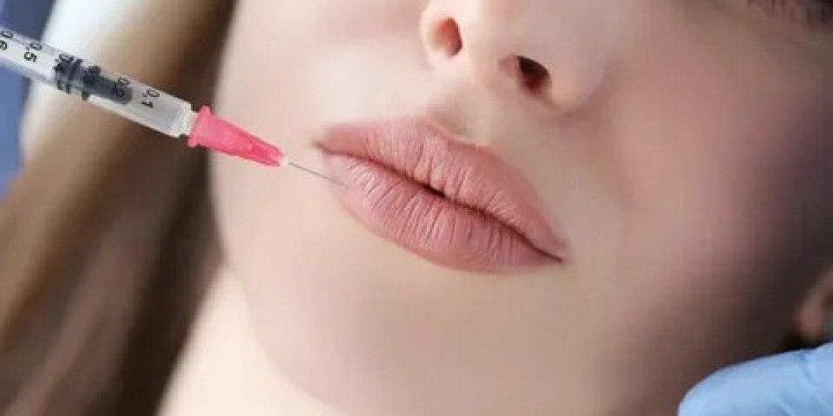 Russian Lip Filler in Dubai: Customized Lip Contouring