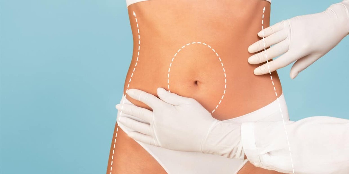 Body Contouring in Islamabad: Transform Your Shape with Modern Aesthetic Solutions