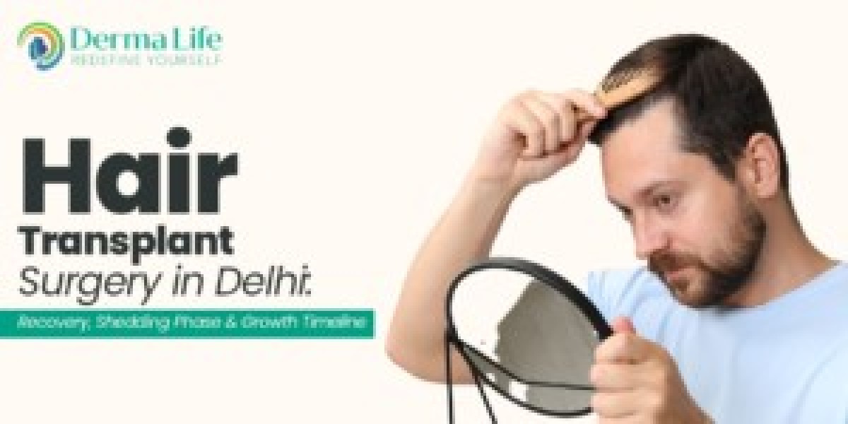 Hair Transplant in Delhi, Noida & Gurgaon: Expert Hair Restoration by Dr. Gaurav Garg at Dermalife