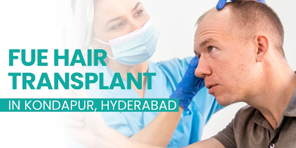 Thinking About a Hair Transplant in Hyderabad? Here’s What You Should Know First