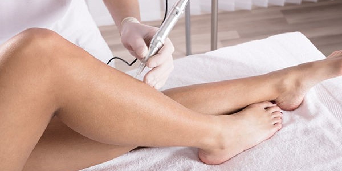 Pros and Cons of Electrolysis Laser Hair Removal In Islamabad You Must Consider