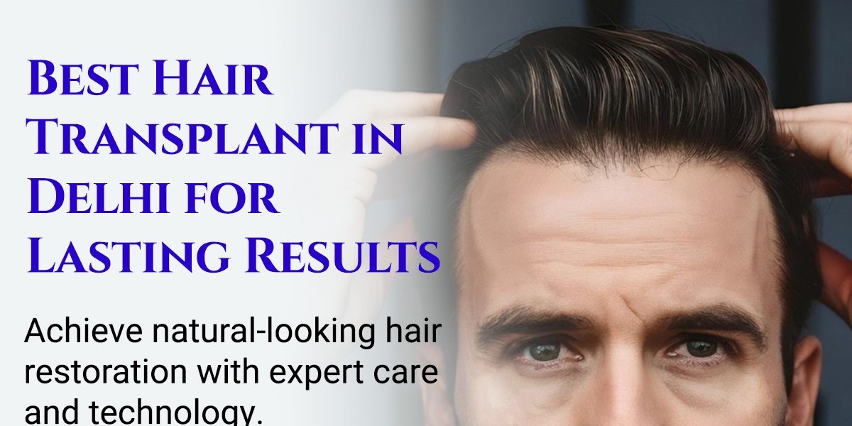 Why More People Are Choosing Hair Transplant Surgery in Delhi — And What You Should Know Before You Decide