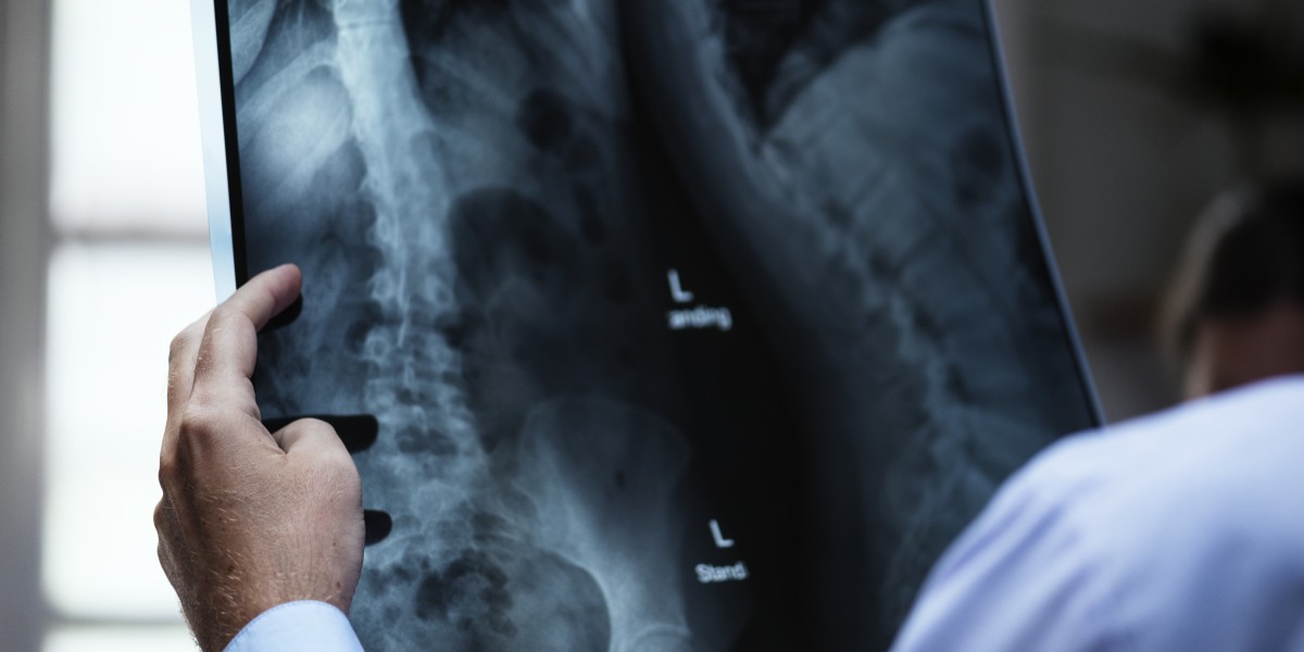 How to Choose the Right X-Ray Clinic Near You