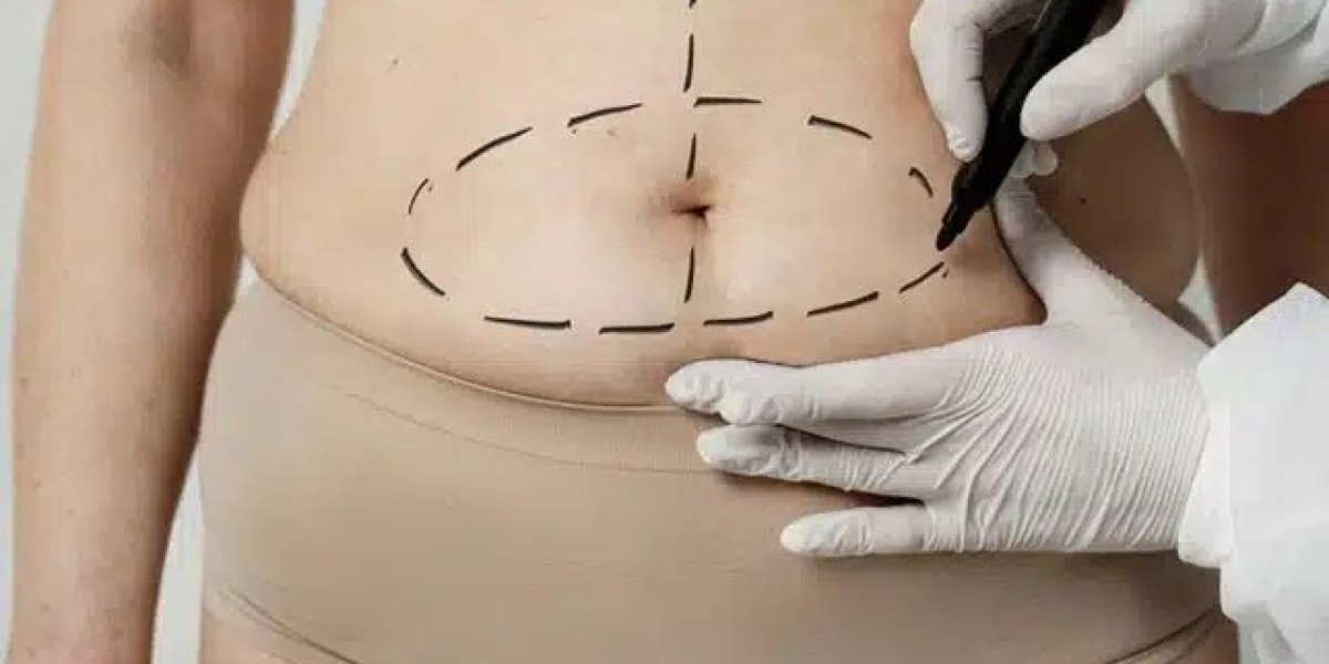 Top Benefits of Choosing Tummy Tuck in Dubai