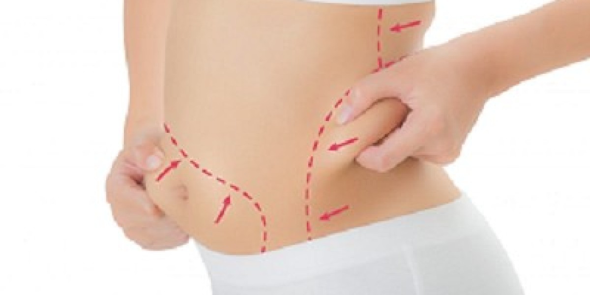 Fat Melting Injection in Dubai: The Ultimate Contouring Guide