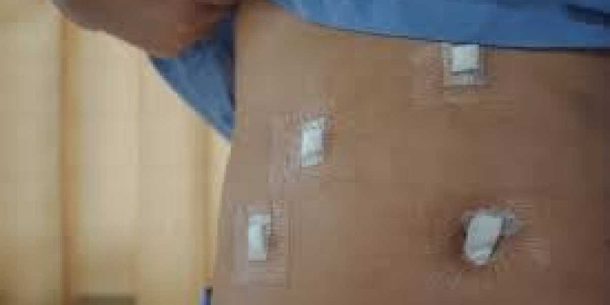Gallbladder Surgery in London, UK: Advanced Care for Safe and Effective Treatment