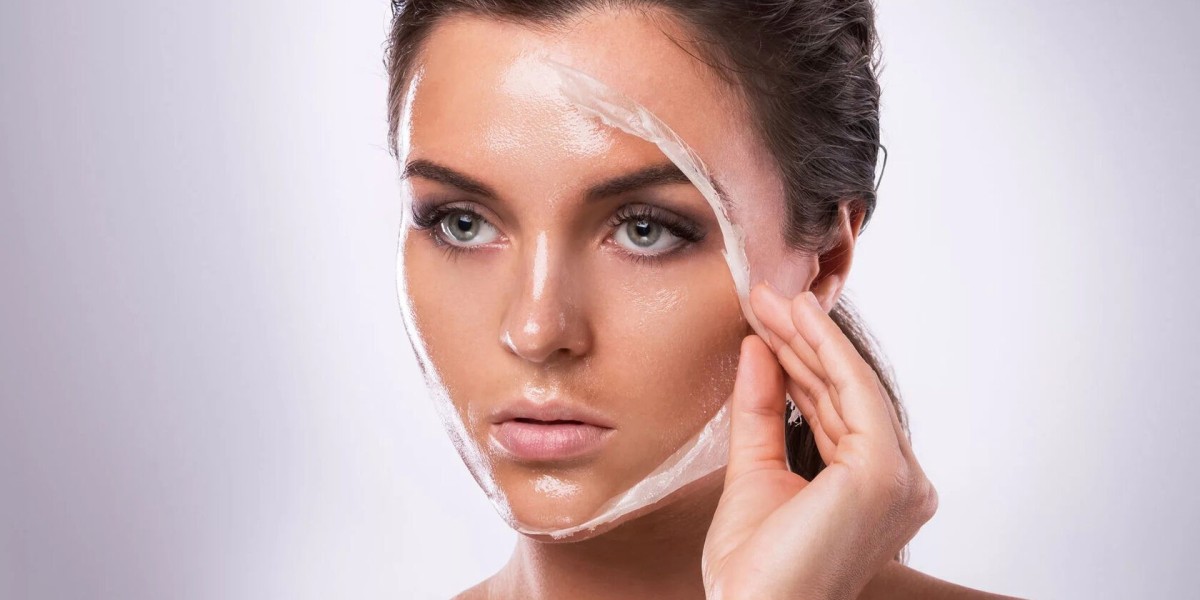 What Are Chemical Peels and How Do They Work?