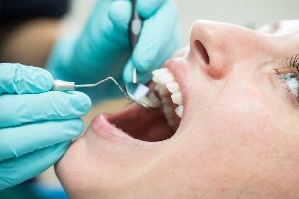 What Is Included In A Teeth Cleaning In Adelaide South -